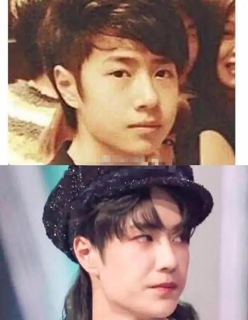 王一博鼻梁透光疑整容?旧照对比判若两人,看看肖战便知为何