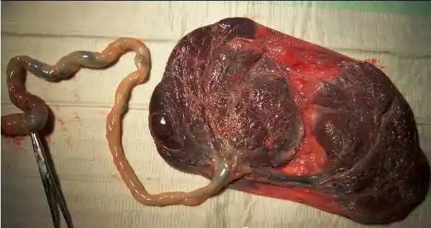 大多数激素都是蛋白质,而胎盘中的激素如孕酮,白蛋白,人绒毛膜促性腺