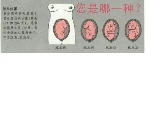 胎位loa是什么意思