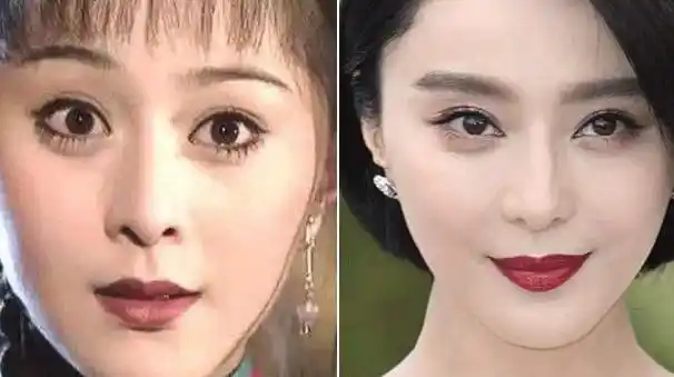 卢丙仑教授:关于开眼角我有话说! - 好大夫在线