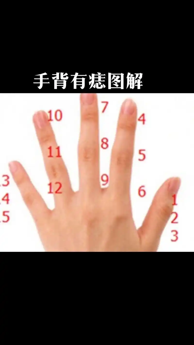 手背痣相图解为了方便解释,我们把人的手指的十五节趾骨标上编 - 抖音