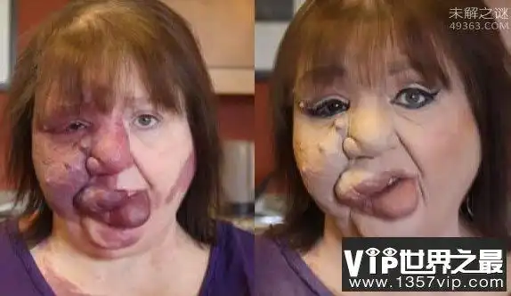 世界上最恶心的人,又丑又恶心的男人和女人(图片)