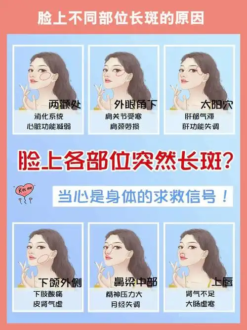 脸上不同部位长斑的原因身体原因导致的斑