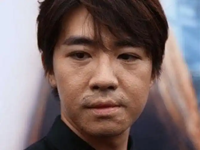 19岁爆红,23岁烧伤毁容,遭女友抛弃,过气10年后他终于逆袭了_俞灏明