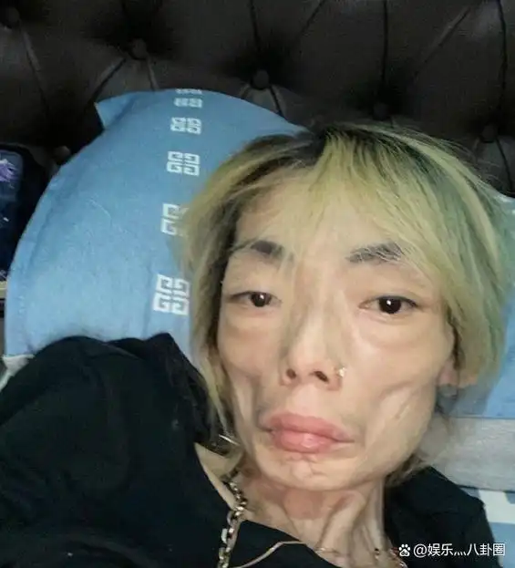 豪门玩物,几年被折磨成牙齿全脱落,不足80斤,半人半鬼惨不忍睹