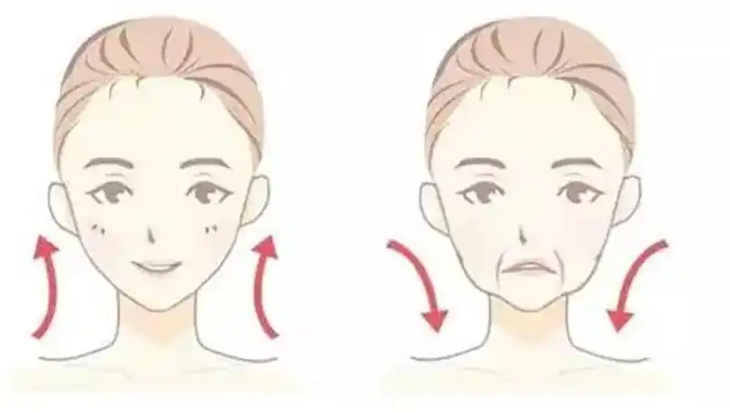 怎样改善面部松弛