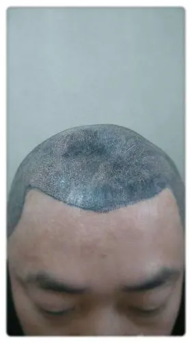 smp纹发失败之靠谱大揭秘:远期形态不可控,切勿懵懂被练手!