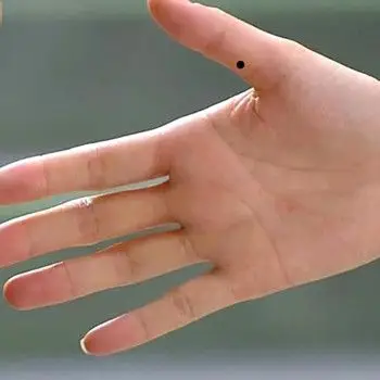 手上长痣有什么含义-痣相图解-华易网