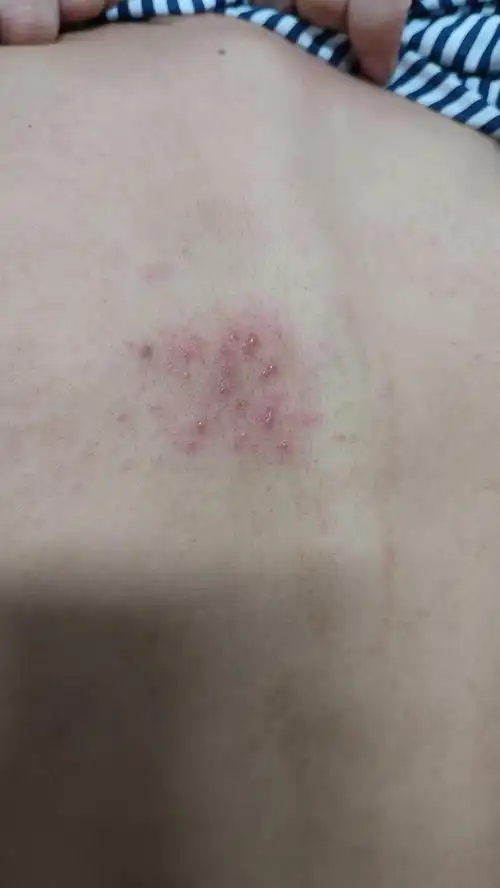 背上长了东西不知道是啥