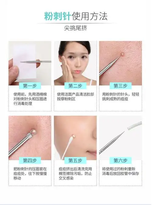 粉刺针细胞夹祛痘挑痘挤痘痘美容院专用去黑头暗疮针工具神器套装
