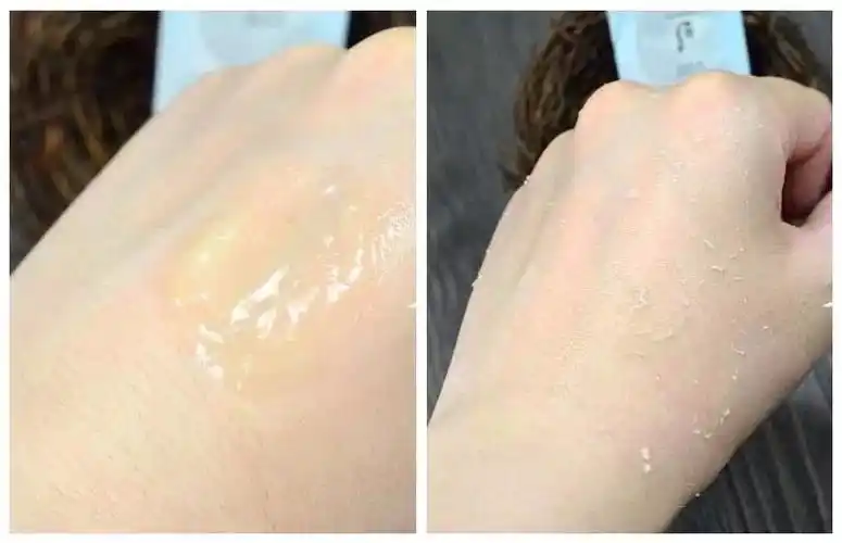 你需要一款去角质的产品了