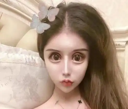 女孩13岁开始整容,砸100万整成"芭比娃娃",如今的脸一言难尽