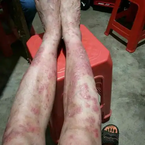 伊尔美面前别"癣"耀自己有多牛