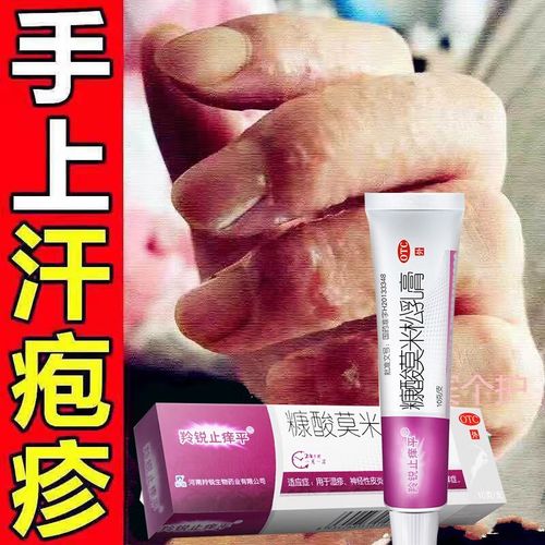 糠酸莫米松乳膏10g皮肤用药可选汗疱疹药膏皮炎湿疹药膏止痒药膏过敏