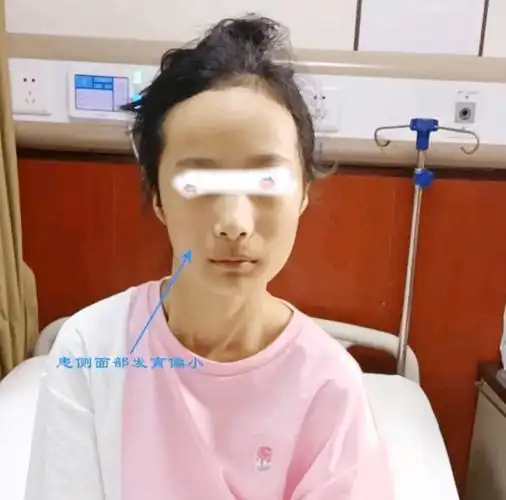 宝宝"歪头杀"看你,虽然看起来很萌,其实可能是病,家长别大意