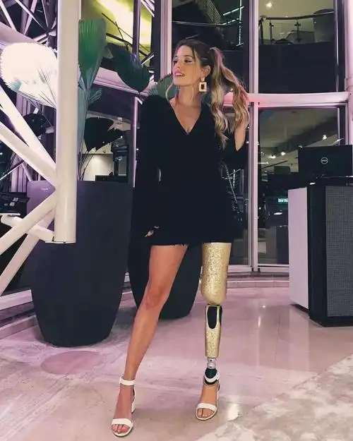 车祸失去一条腿她装上假肢变身美丽机械姬更加美丽闪耀