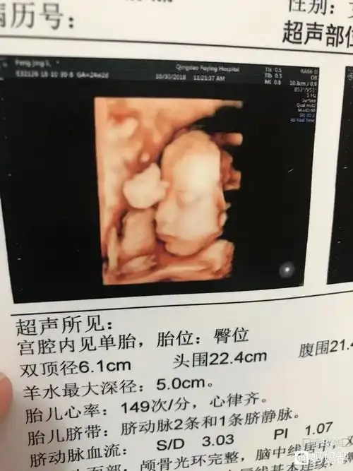 来听听!四维看男孩女孩诀窍"弘于一人"-第2张图片-西口博客