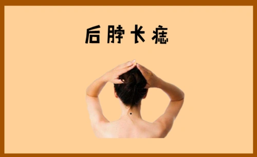 靠山痣,身体4颗吉痣,正财稳,横财快,个个财大气粗不差钱!