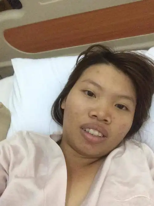 女孩太丑被男友甩了花20万元去整容结果美的让数名小伙疯狂追求