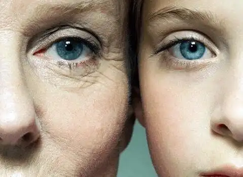 皮肤松弛怎么办皮肤松弛怎么改善