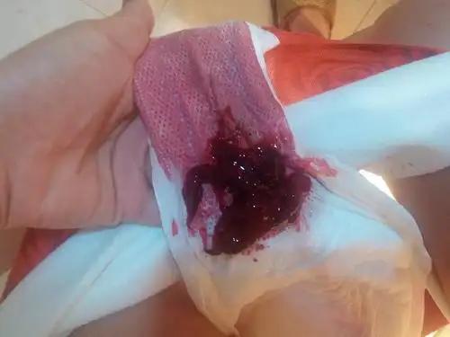 你好,我每个月9号来月经的但是这个月一直到昨天早上