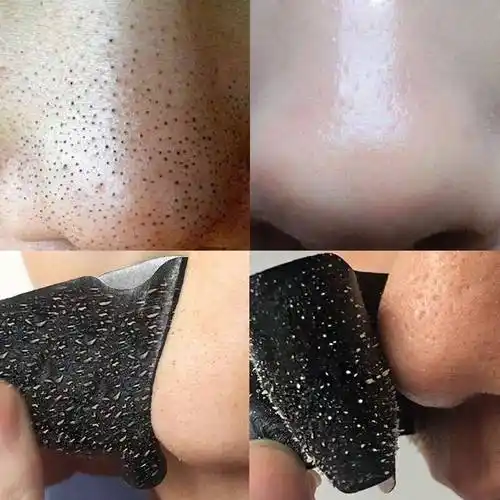强去黑头鼻贴猪鼻贴撕拉式去黑头去粉刺鼻贴竹炭 吸黑头贴黑头贴