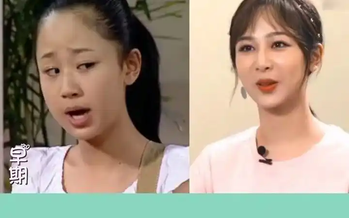 《家有儿女》演员今昔对比,杨紫从小美到大,小雨"毁容式"长大