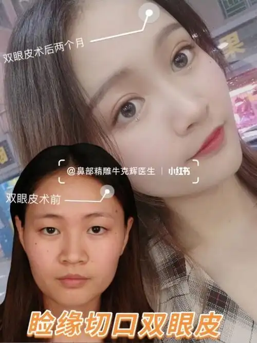 到底是双眼皮好看还是单眼皮呢显而易见