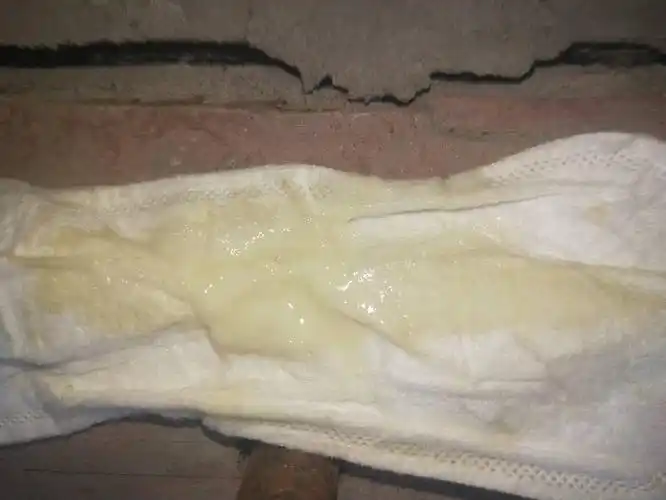 这样的的白带增多算不算异常?