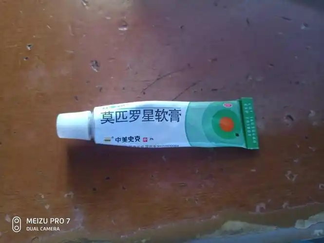 人皮肤瘙痒可以涂这种药膏吗