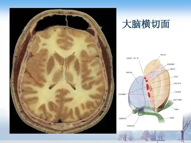 大脑横切面