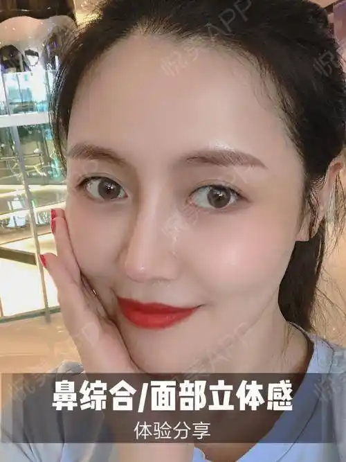 不过我还是在坚持用疤痕药,毕竟现在也还是在恢复期,鼻综合是采用皮下