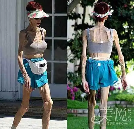 可是当她们暴瘦成瘾,排骨尽显的时候,网友又不由的惊呼:太吓人了!