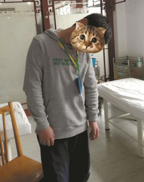沉迷于当低头族10岁男孩犯了颈椎病脖子歪了