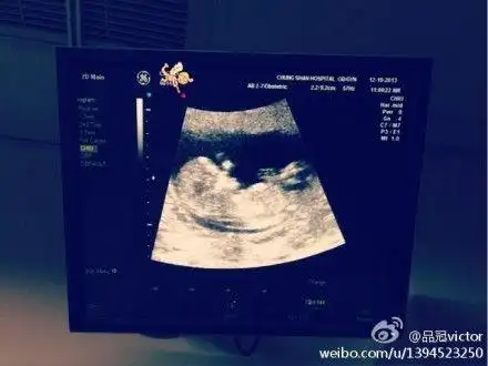 品冠晒出老婆b超照