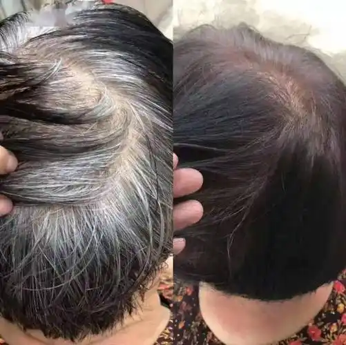 洗一次15分钟染黑15分钟发膜一周洗2次白发自然变黑发中草药养发好