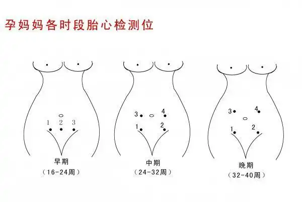 怀孕14周大概在什么位置可以找到胎心!