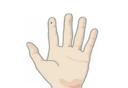 食指有痣代表什么意思 左手食指痣相图解