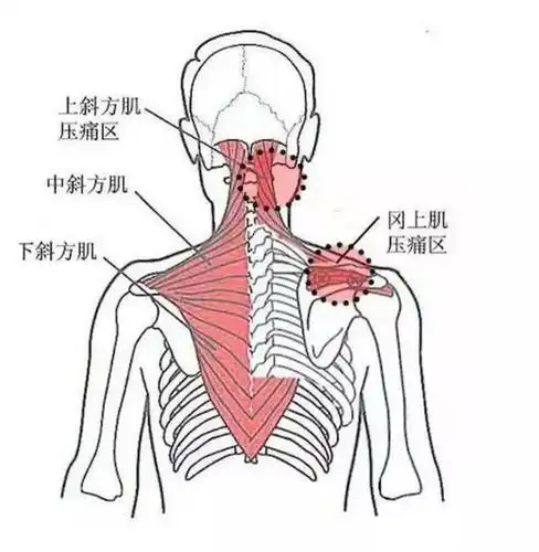 7.肩胛提肌压痛点