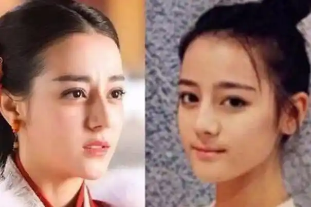 迪丽热巴整过容吗 迪丽热巴整容前照片对比图曝光