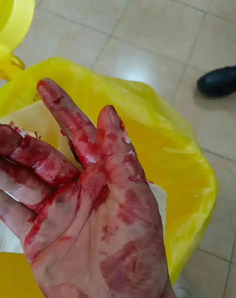 而只是责怪自己不小心,手在流血心在滴血,而只是责怪自己不小心 - 抖