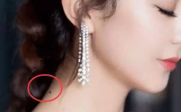 脖子有痣的女人寓意好不好