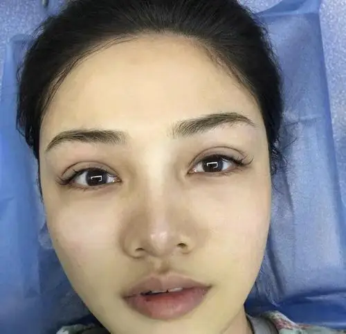 自然欧式双眼皮图片大全