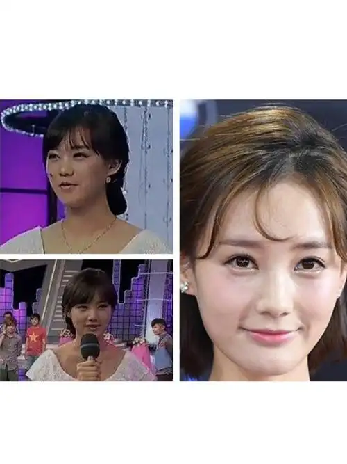 永远的女主李一桐,"整容史"比后台还精彩 李一桐的_圈子-新氧美容整形