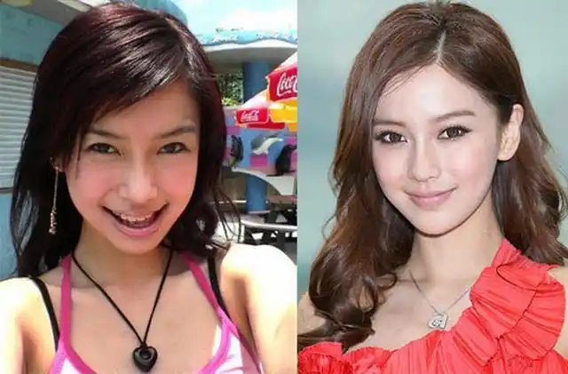 angelababy出道前后差别太大难道牙齿矫正真的能改变脸型吗