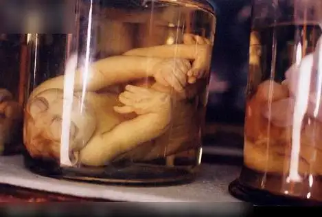 医学院解剖用的尸体是从哪里来的