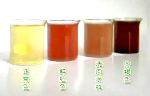 到底什么样的小便才是健康的?