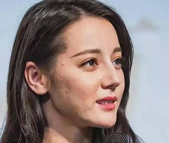 迪丽热巴,谁失去了她的美丽修图,她所有的缺陷都暴露在她的脸的照片