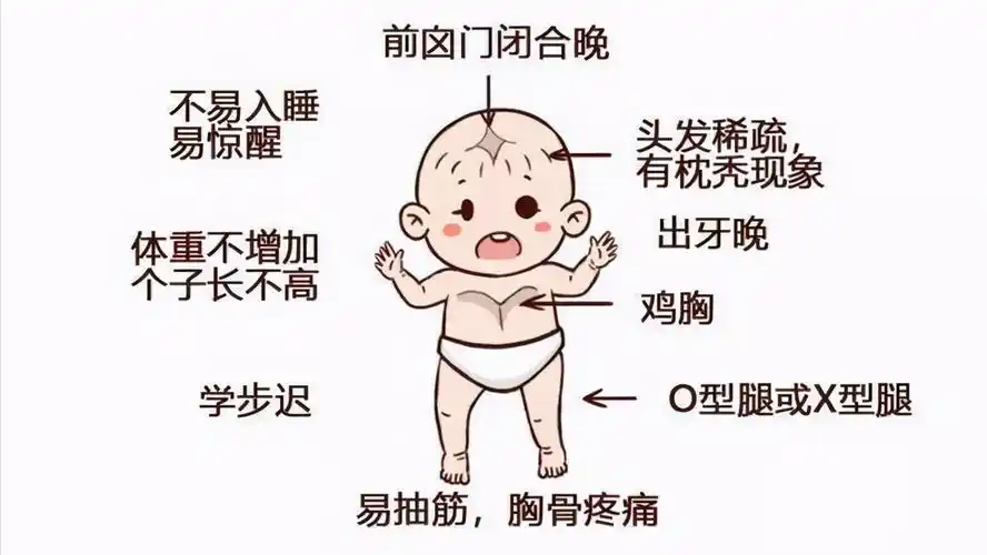 婴儿方颅症状的照片(医生提醒)-幼儿百科-魔术铺