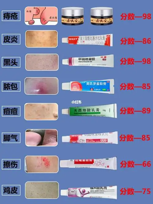居家必备良心药膏92平价药膏出奇迹_药膏_乳液_皮炎_红霉素软膏